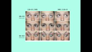 眼科疾病精讲：视网膜、角膜、青光眼与常见眼病临床要点 封面