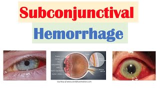 眼科常见病系统课：结膜、角膜、视网膜、黄斑与眼睑疾病 封面