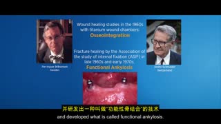 种植牙临床实战：从骨结合到数字化全程系统学习 封面