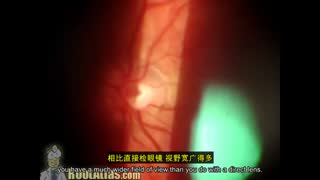 眼科临床体征图谱：裂隙灯检查、角膜病变与手术并发症识别 封面